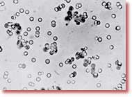 Foksun “Proteinoid”ləri Millerin fikirlərindən təsirlənən Sidney Foks bəzi amin turşularını birləşdirərək “proteinoid” a