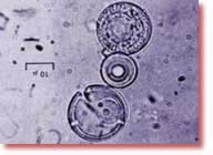 Foksun “Proteinoid”ləri Millerin fikirlərindən təsirlənən Sidney Foks bəzi amin turşularını birləşdirərək “proteinoid” a